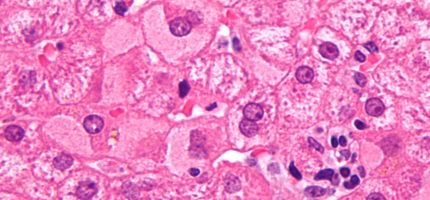 Itâ€™s Time to Test, Treat and Cure