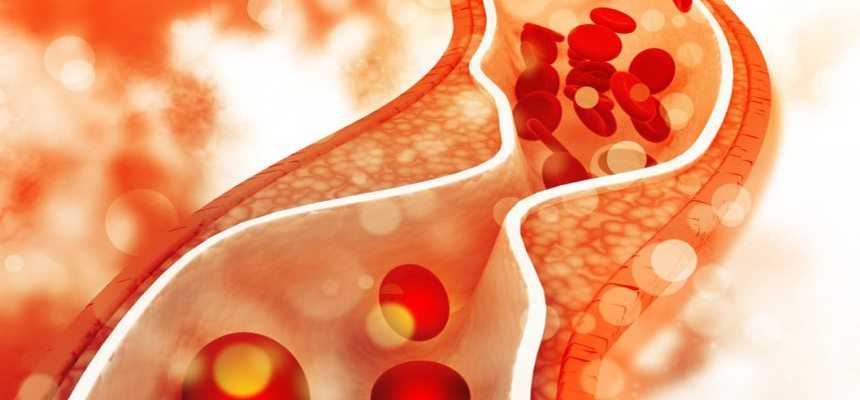 Cholesterol and its Impact on Health