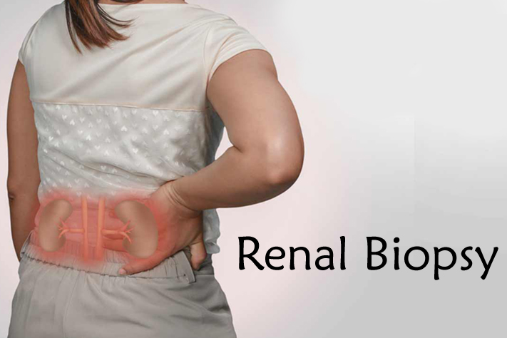Renal Biopsy â€“ The Specialty at Aware Gleneagles Global Hospital