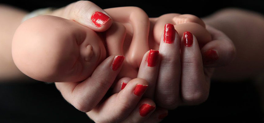 Unsafe abortions – a matter of concern