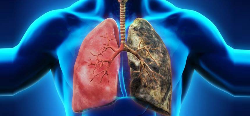 Cure for Interstitial Lung Disease is Here