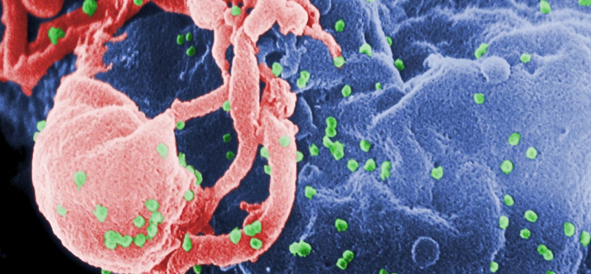 Donor cuts could threaten global progress on HIV, new research warns