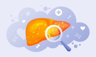 Alcoholic Liver Disease: A Growing Concern