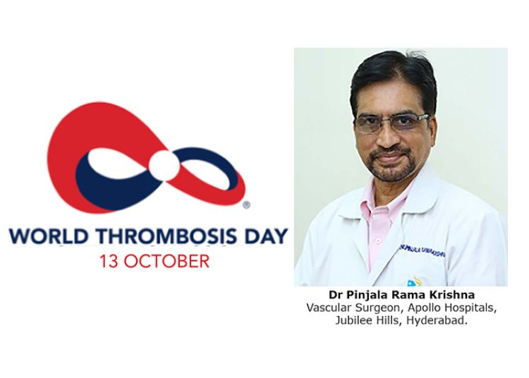 World Thrombosis Day – October 13th 2023