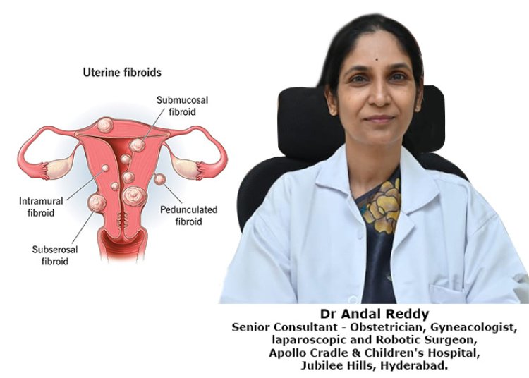 Fibroids in uterus? – what do we need to know.
