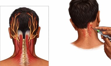 From Daily Debilitating Pain to Relief: How Advanced Migraine Therapies Are Changing Lives at Aster Prime Hospital
