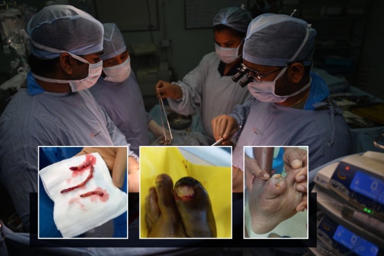 CARE Hospitals, Malakpet Gives 67-Year-Old a Second Chance to Walk