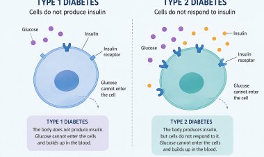 Diagnosing type 1 and type 2 diabetes