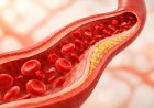 Cholesterol and its Impact on Health